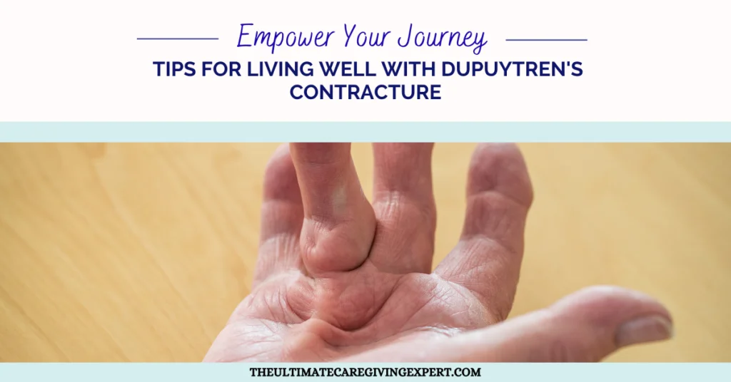 How To Effectively Help Live With Dupuytren’s Contracture Disease